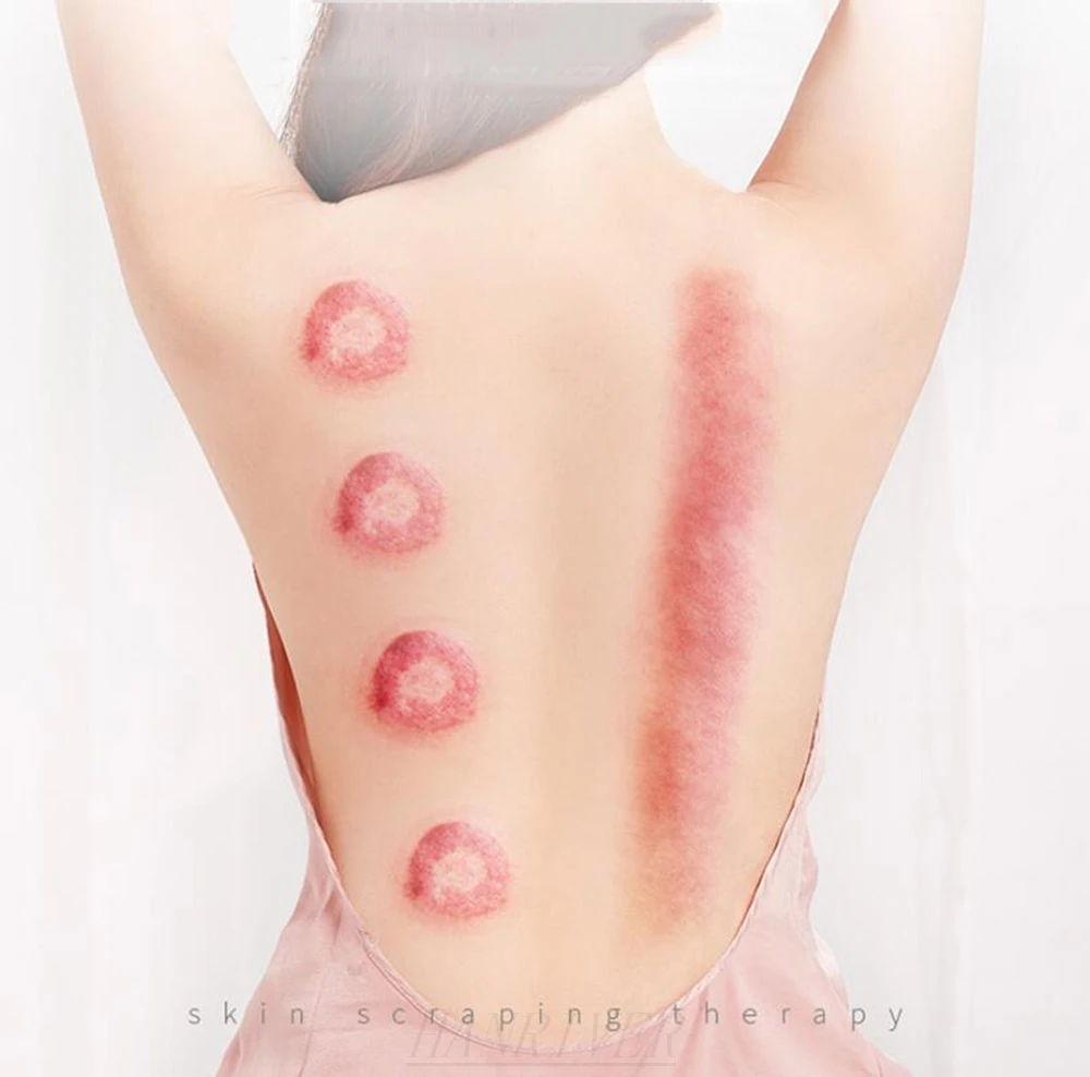 Scrapping instrument cupping electric five lines of meridian brush household detoxification multifunctional massagers