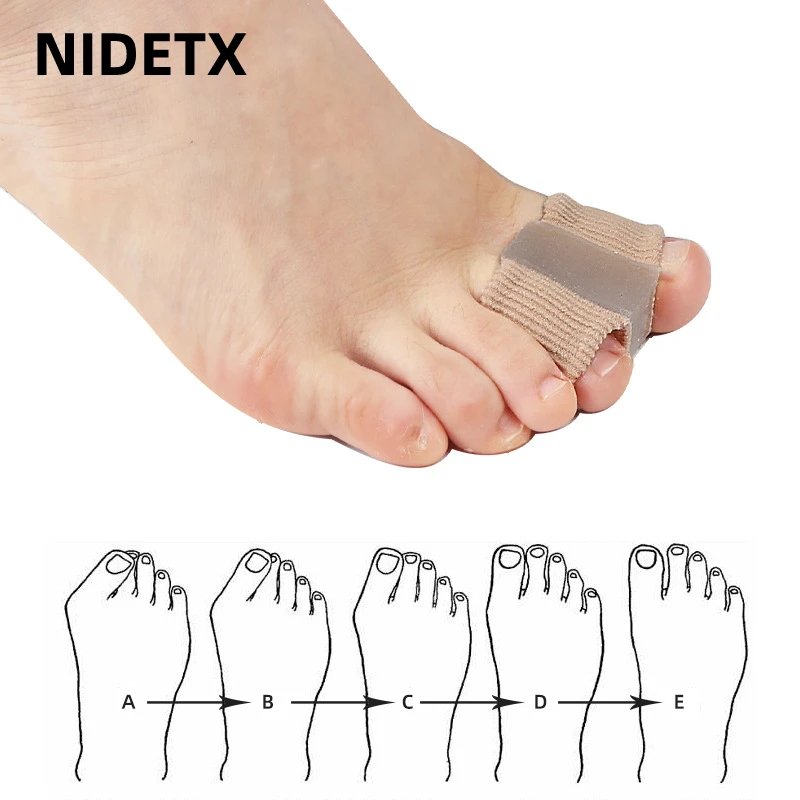 Silicone Toe Spreader Finger Separator Bunion Hallux Valgus Corrector Thumb Correction Straightener Foot Care Orthopedic 1Pcs toe separators toe spreader toe corrector finger toe separator