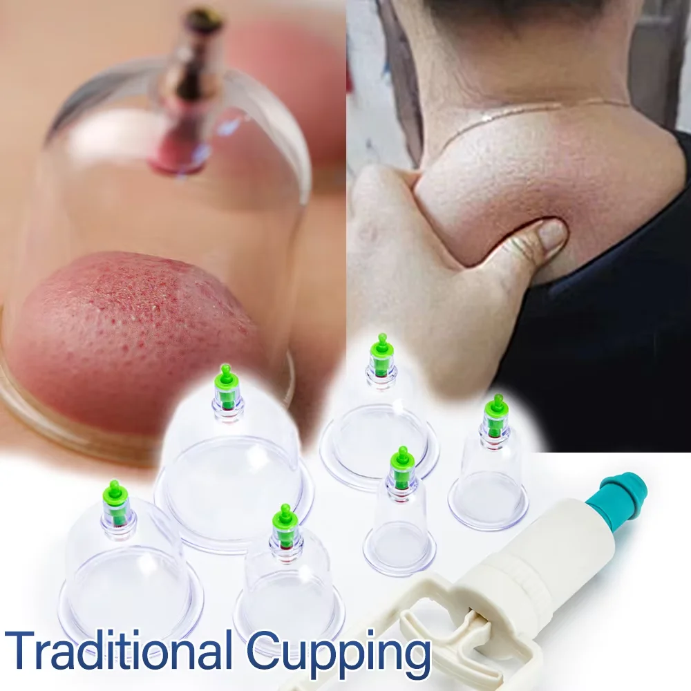 6or12 Pieces Suction Cups Massage Vacuum Cupping Body Massager Chinese Cupping Therapy Cans Cupping Set Cans for Massage 3