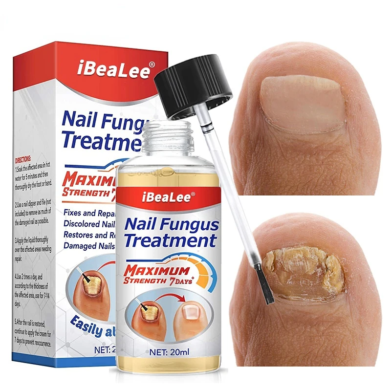 Nail Fungus Treatment 7days Repair Essence Serum Hand Care Nails Foot