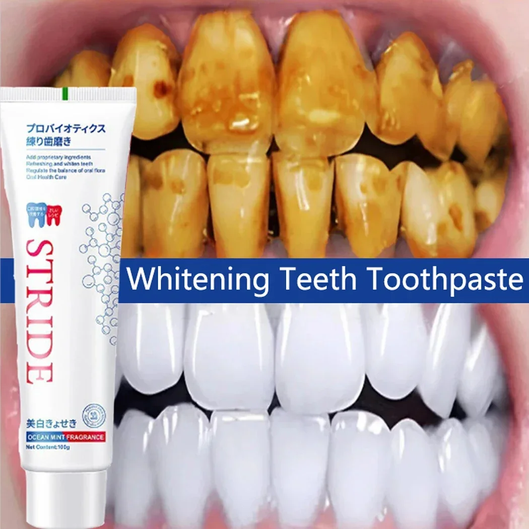 Dental Calculus Remover Teeth Whitening Toothpaste Oral Hygiene Cleaning Remove Plaque Stains Prevent Periodontitis Fresh Breath
