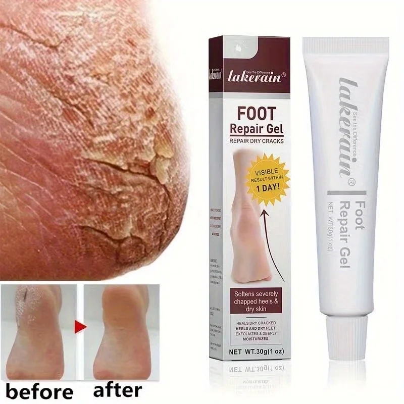 

Fall Winter Heel Moisturizing Hydration Foot Deep Persistent Repair Gel Foot Spa Maintenance Easy To Push Away Quick Effect