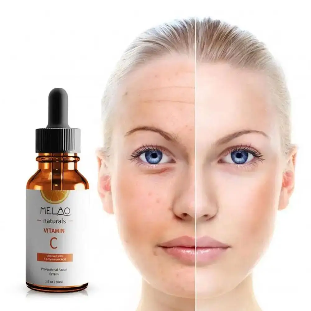 

30ml Vitamin C Serum Remove Freckles Anti Wrinkle Firming Fade Serum Skin Bright Fine Care Lines Face Repair Moisturizing K6T7