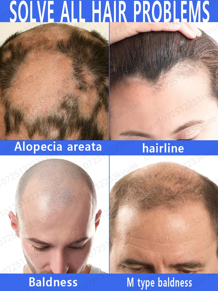 Grow back lost hair stop baldness loss in 7 days