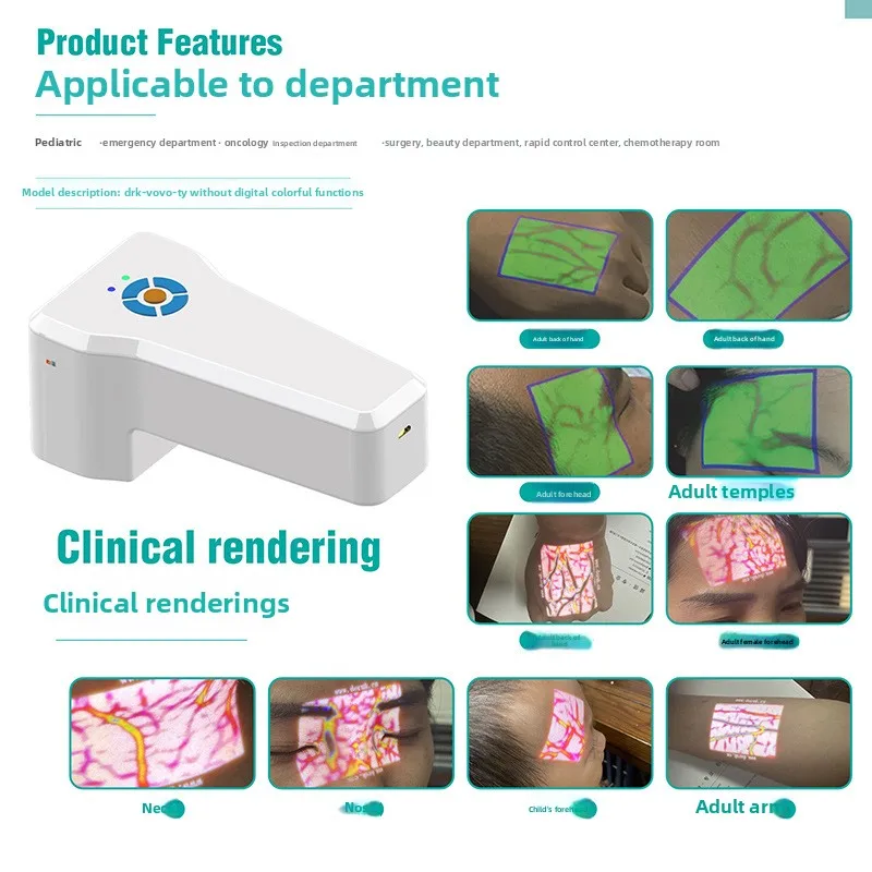 Medical Venous Imaging Instrument Beauty Vascular Finder for Limb