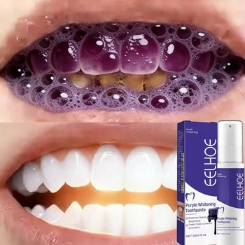 Dentifricio Sbiancante Bestseller 2026: Dì Addio ai Denti Gialli, Strumento per l'Igiene Orale e la Cura dei Denti