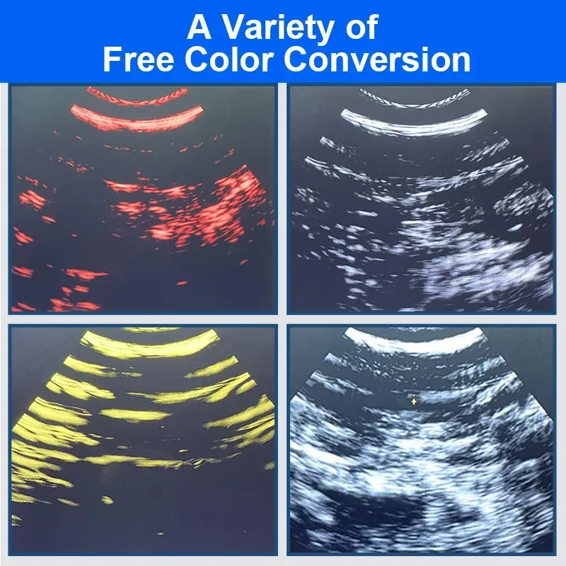 Wireless Veterinary Ultrasound Scanner New Portable Mechanical Pregnancy Test Handheld Ultrasound Machine Pig Sheep For Andorid 5