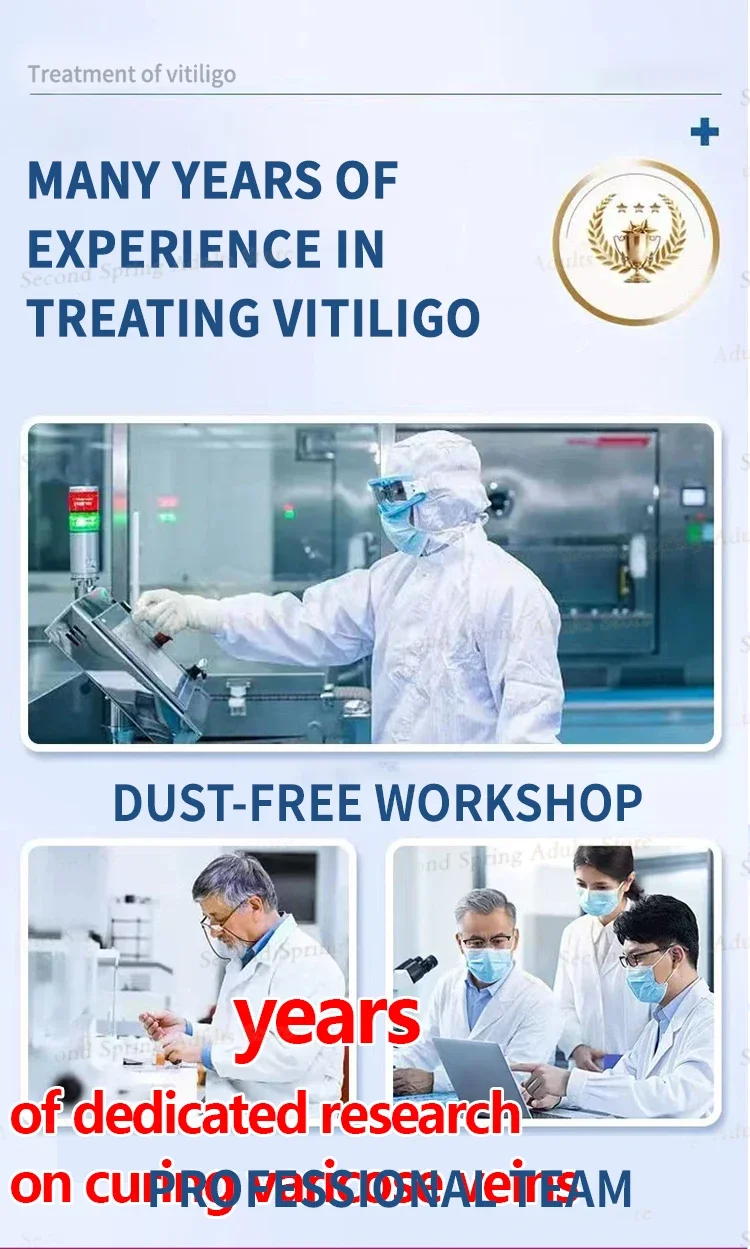 Penna a luce blu di seconda generazione (2025): strumento per risolvere il problema della vitiligine._voghion.com