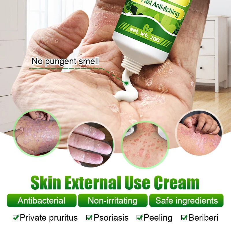1pcs Private Part Anti-itch Cream Anal Itching Cream Psoriasis Glans Penis Itch Scrotal Eczema Odor Antifungal G024