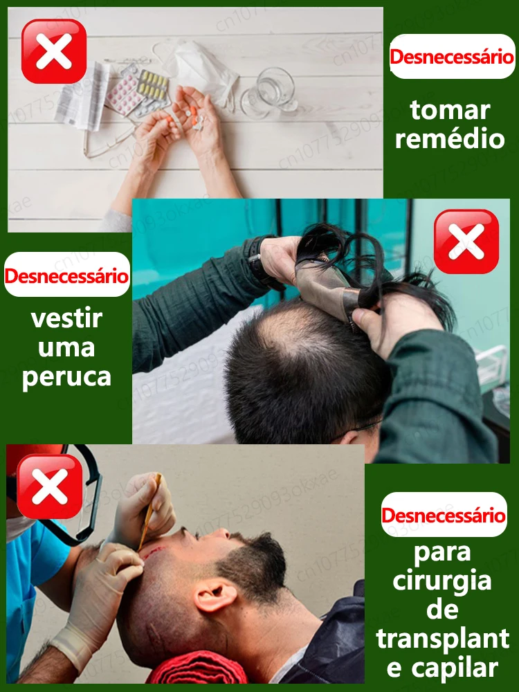 Óleo essencial anti-alopecia para o crescimento rápido do cabelo, soro gengibre