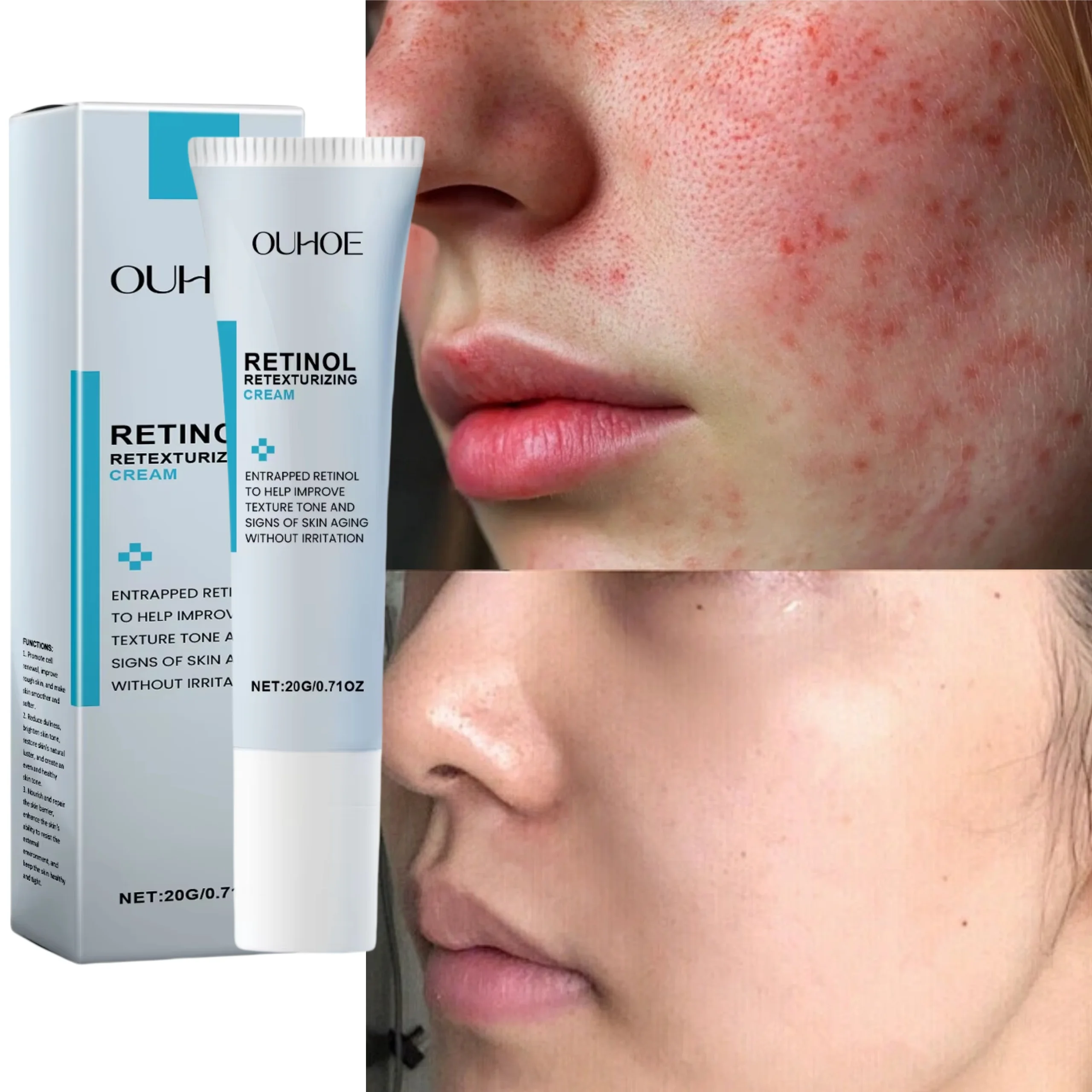 Facial Redness Relief Moisturizing Cream