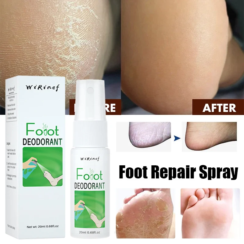 

Anti Cracked Foot Spray Softening Calluses Remove Dead Skin Odor Anti Dryness Peeling Relieve Itch Sweat Exfoliating Feet Spray