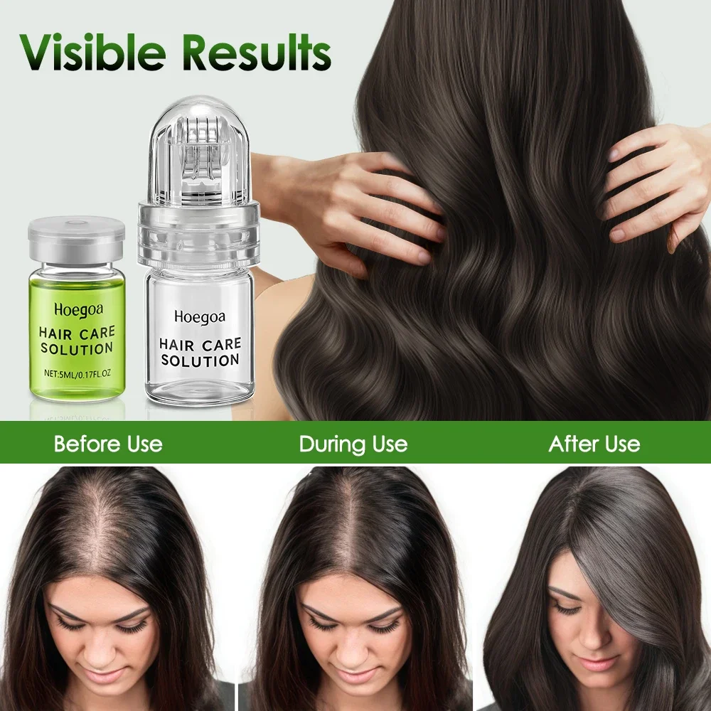 Hair Essential Care Serum Strengthen Roots Reducing Loss Prevent Baldness Nourish Scalp Hair Care 4