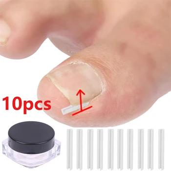 10PCS Nail Correttore Unghia Incarnita Striscia di Riempimento di Plastica Paronichia Trattamento Regolatore Strumento di Pedicure Cura Del Piede Riempito Pad 1
