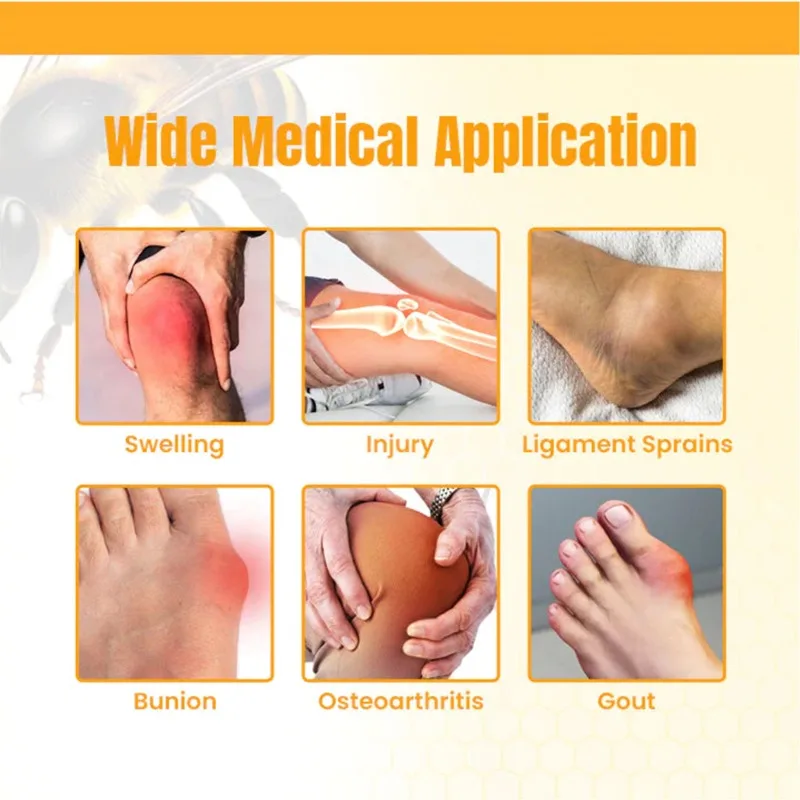 Bee Venom New Zealand Treatment Gel Cream Relieve Muscle Joint Pain for Legs Hands Arms Feet Health Care