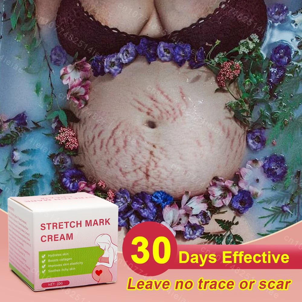 Pregnancy Mark Removal Cream Permanent Repairs Damaged Skin Natural Ingredients Remove Abdominal Pregnancy Line Without Stains