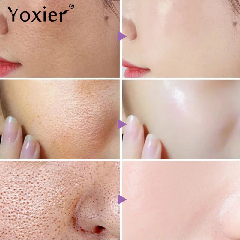 Рисунок 2 - Маска для лица для сна