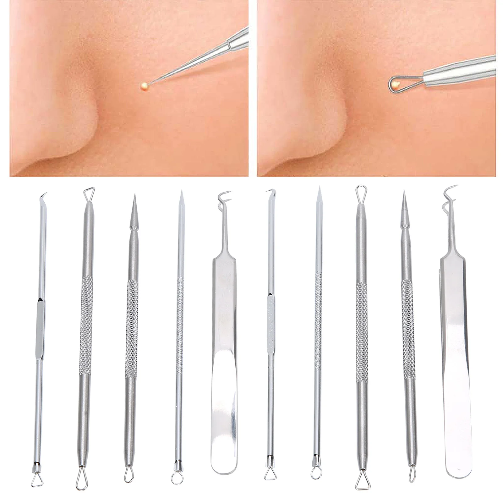 

Blackhead Removal Extractor Tool Set Stainless Steel Pimple Acne Extraction Removal Needle Pore Cleaning Kit Skin Care Tool