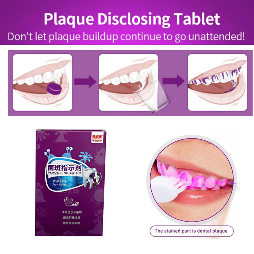 DentalPlaqueIndicatorTabletsTeethPlaqueDyeDetectorDisclosing