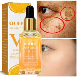 Vitamin C Whitening Face Serum Remove Dark Spots Freckles Fade Melanin Retinol Anti-wrinkle Essence Brightening Beauty Skin Care