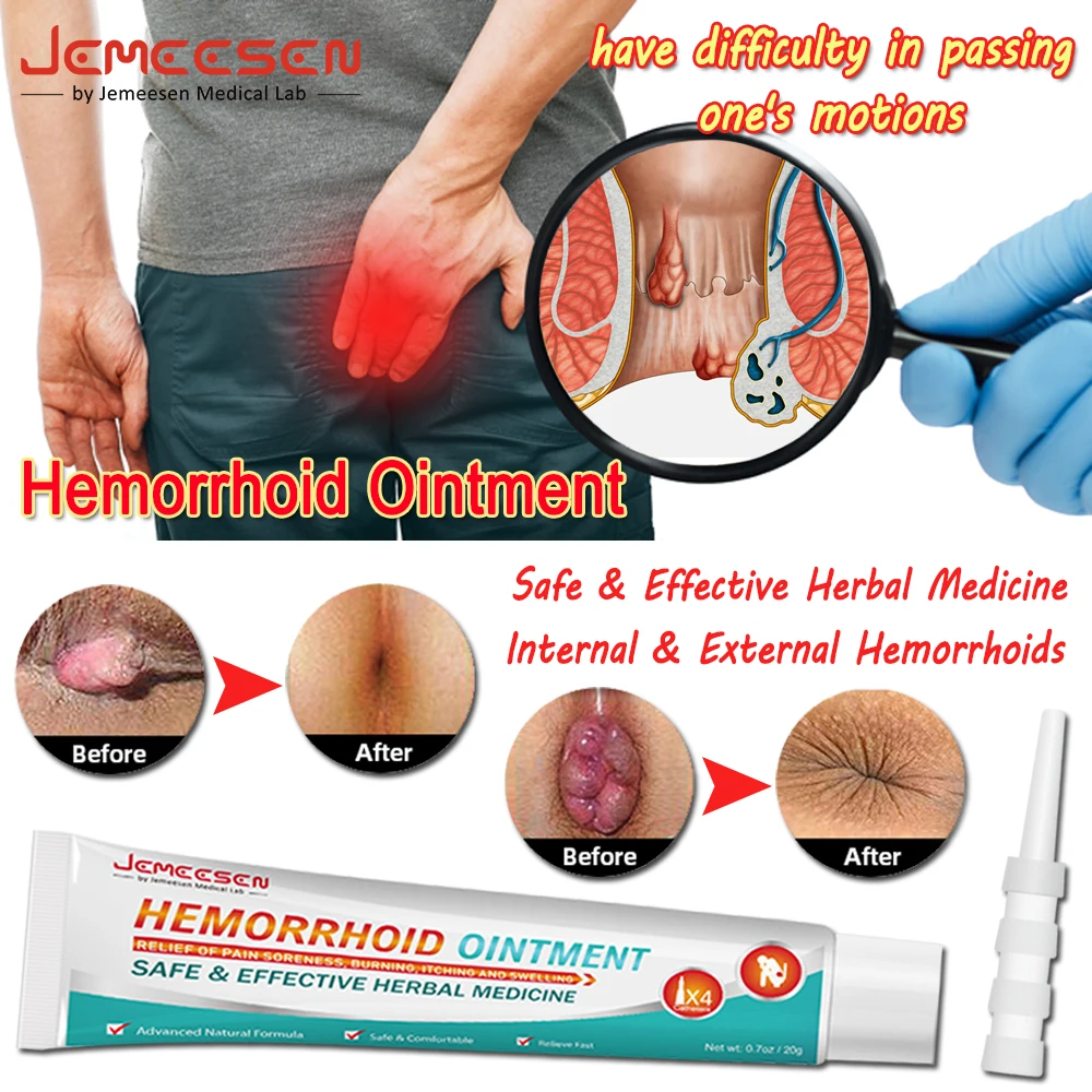 

Hemorrhoid Ointment Relief Pain Soreness,Burning,Itching Swelling Plaster Treat Internal External Hemorrhoids Sterilize Cream