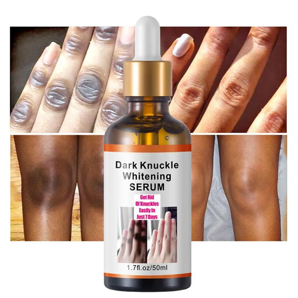 50ml Dark Knuckles Remover Cream Whitening Serum Elbow Knee Armpit