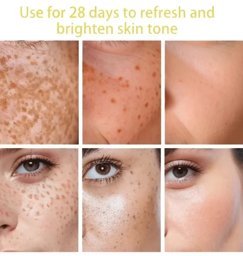 Powerful Dark Spots Remover Freckle Whitening Serum Melanin Correcting Anti Pigmentation Brighten Korean Day Night Facial Care 2
