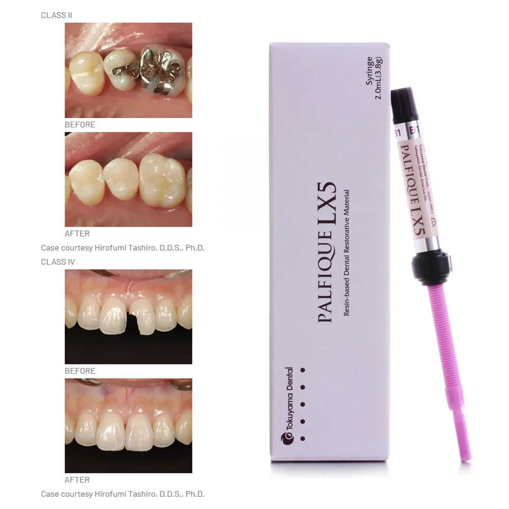 DentalMaterialsTokuyamaPalfiqueLx5ResinbasedDentalRestorative