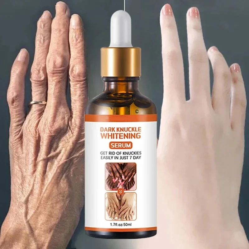 Brightening Serum Lightens Knuckles Fingers Elbows Knees Improves in Body Skin Melanin Nourishes Care for Moisturizing Cream 2