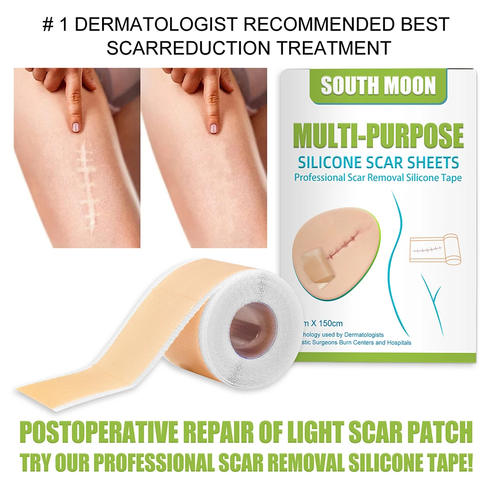 150cm Silicone Scar Tape Removal Patch Acne Gel Scar Therapy Silicon Tape Patch Remove Trauma Burn Skin Repair Sheet scar removal gel patch