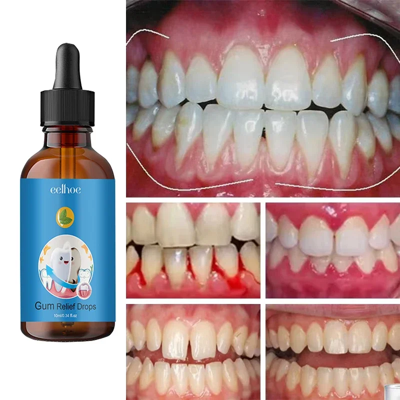 21 Rapid Repair Gums Serum Effectively Relieve Tooth Allergy Dental Caries Tooth Cleaning Toothpaste Relieve Damage Drops
