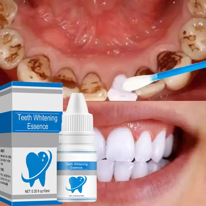 Teeth Whitening Product Teeth Whitening Essence Teeth Health Product Teeth Whitening Essence Remove Against Dental Caries Plaque Stains Serum Fresh Breath Oral Hygiene Dental Tooth Cleaning Tools