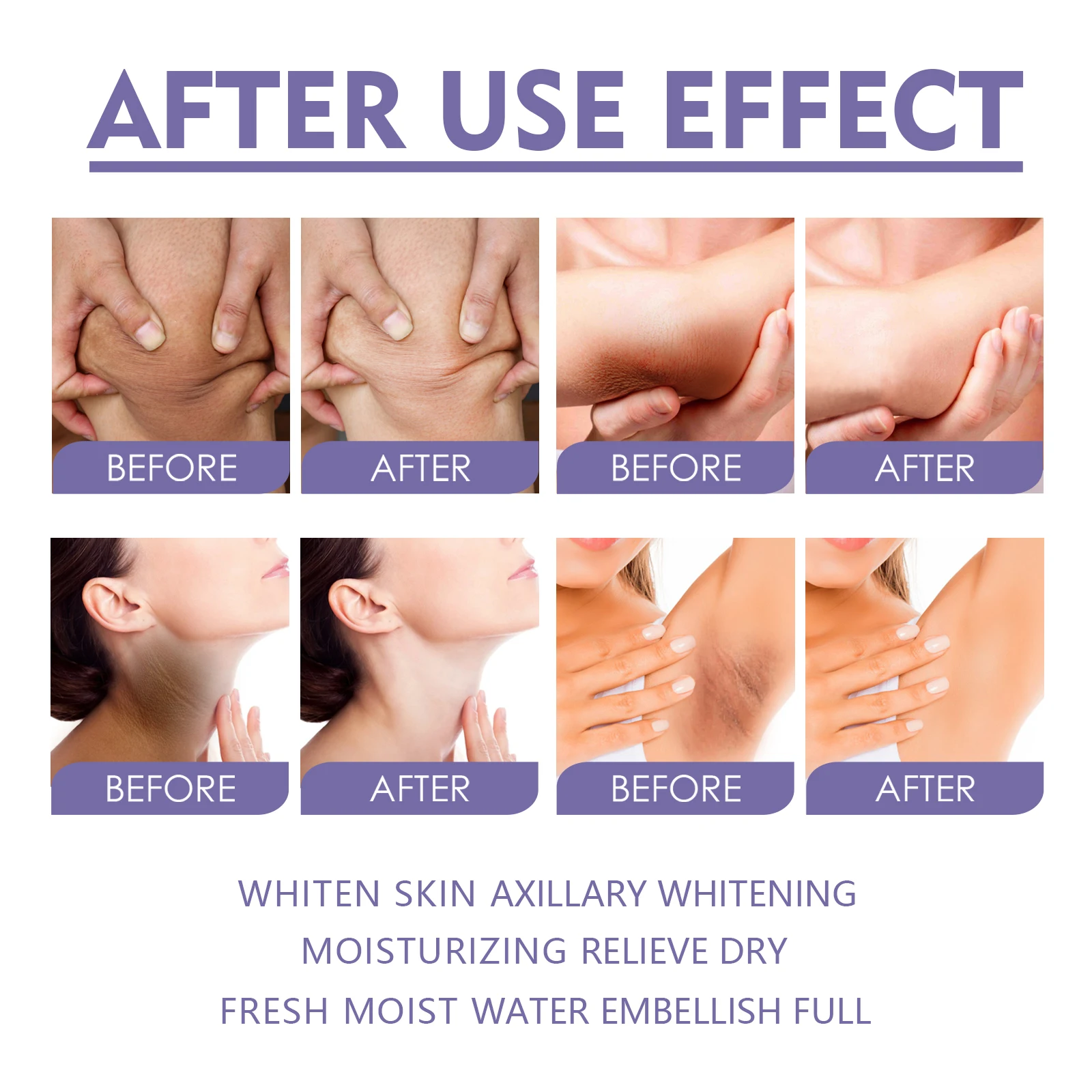 Targeted Dark Spot Bleaching Cream Stick for Body by EELHOE