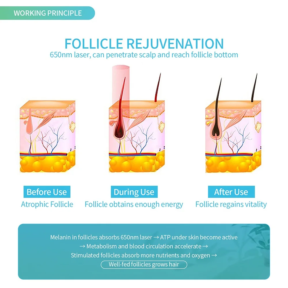 Hair Growth Helmet Hair Regrowth Laser Infrared 180PCS LED Light Hair Loss Treatment Cap Anti Hair Loss Restore Hair Thickness