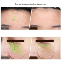 EMS Facial Body Radio Frequency Machine Skin Tightening Face Lifting RF Beauty Device Professional Home RF Skin Care Anti Aging 2
