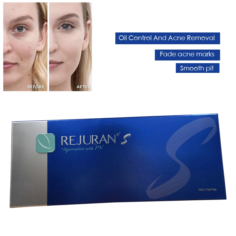 Korea REJURAN Blue Box Face Moisturize Promote Collagen Production Wrinkle Firm Remove Acne Marks Mesotherapy Solution |