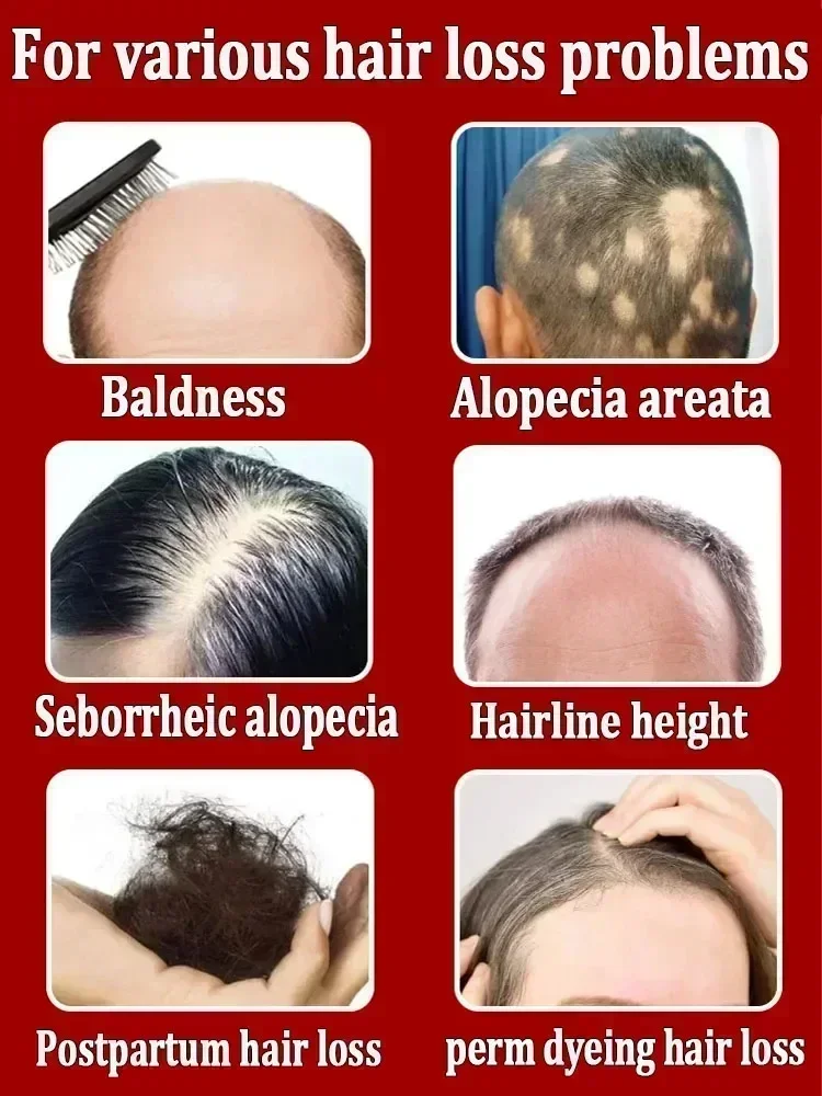 Get more hair say goodbye to baldness thick hair