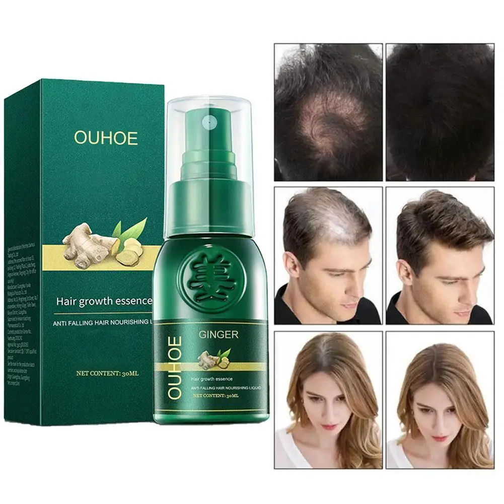 

Ginger Spray Products Natural Anti Hair Loss Serum Prevent Baldness Treatment Fast Grows Nourish Damaged Hair Care