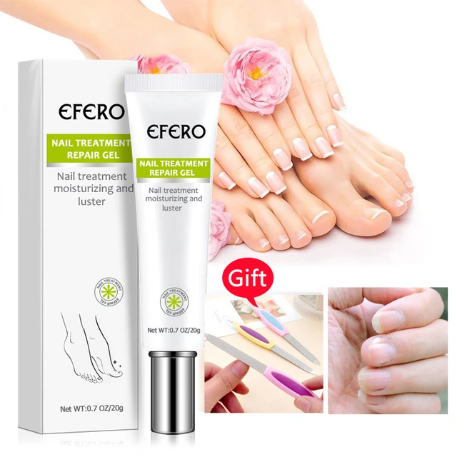 Fungal Nail Treatment Feet Care Nail Foot Whitening Toe Nail Fungus Removal  Gel Anti Infection Paronychia Onychomycosis at best price in Meerut | ID:  2853393680491