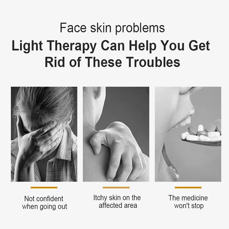 Uvb 311nm Narrow Band Light Therapy Lamp Instrument For Psoriasis Vitiligo Skin Disease Treatment Anti-White Spot uvb light therapy lamp