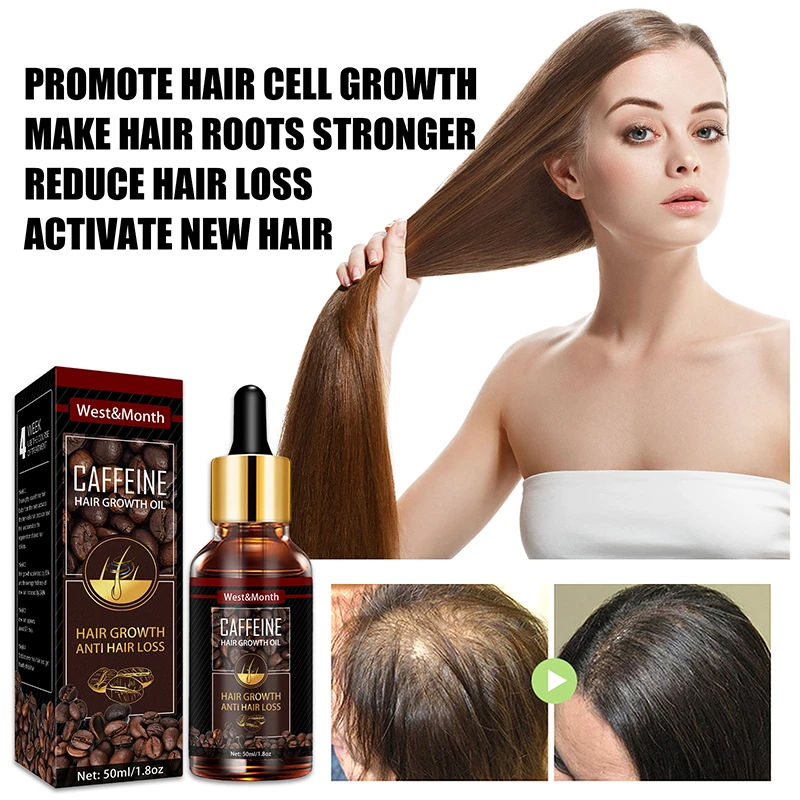 Hair Growth Liquid Essential Oil Spray Caffeine Ginger Scalp Massage  Nutrition Essence Nourishing Anti-loss Hair Cream Hair Care - Hair Loss  Product Series - AliExpress