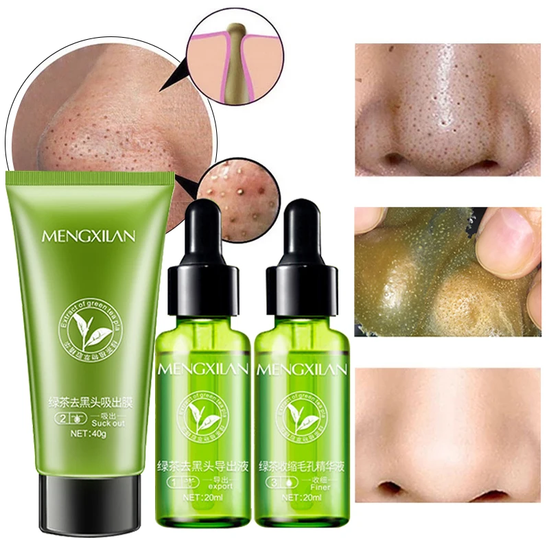 Blackhead Remover Kit Face Serum Exfoliate Shrink Pores Oil Control Peel Off Mask Whitening Green Tea Gentle Skin Care 3Pcs/Set 3pcs set turmeric face care sets facial acne cleansing cream anti aging serum remover dark spots whitening facial oils skin care