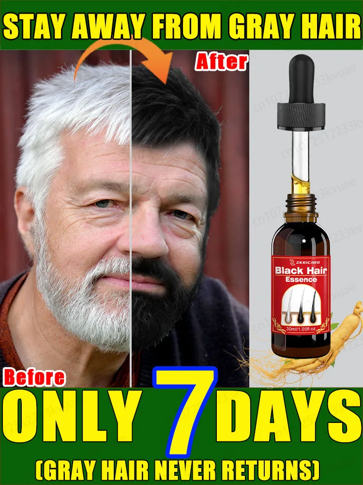 White hair killer remove white hair in 7 days and restore natural color natural formula for hair color restorer
