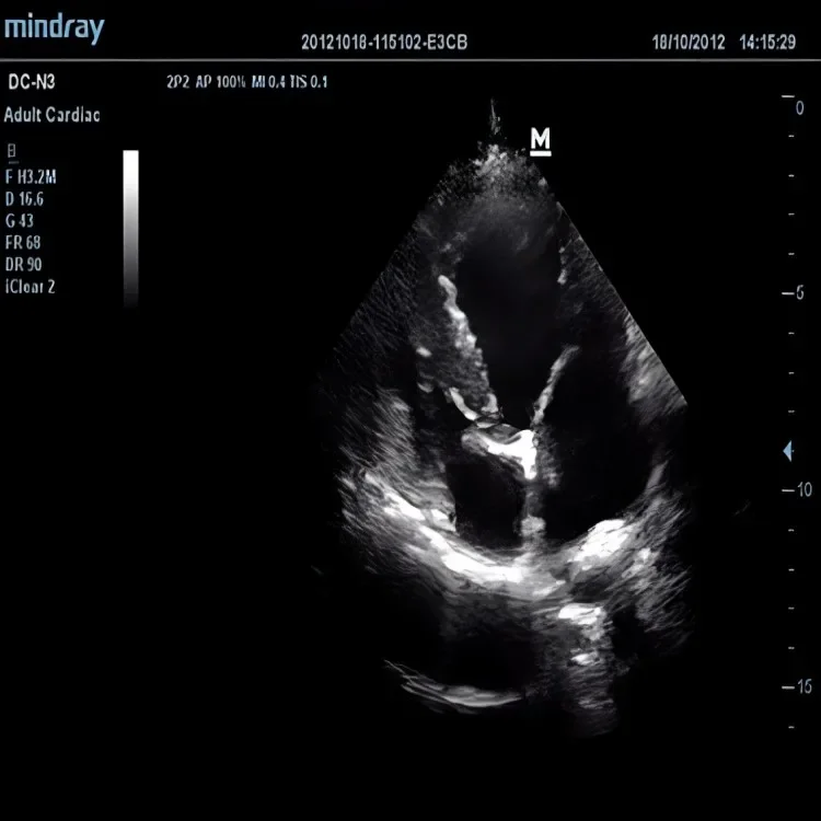 Рисунок 4 - EC Mindray ультразвуковой компактный сканер животных