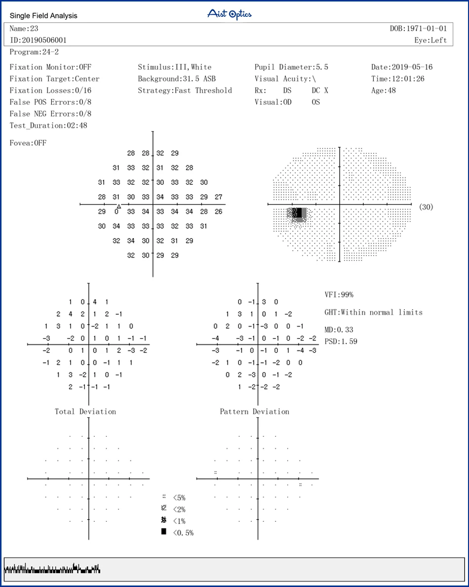 Automatic Eyeball Peripheral Vision Auto Perimeter Visual Field Analyzer with Printer Optical Instruments Ophthalmic Equipment