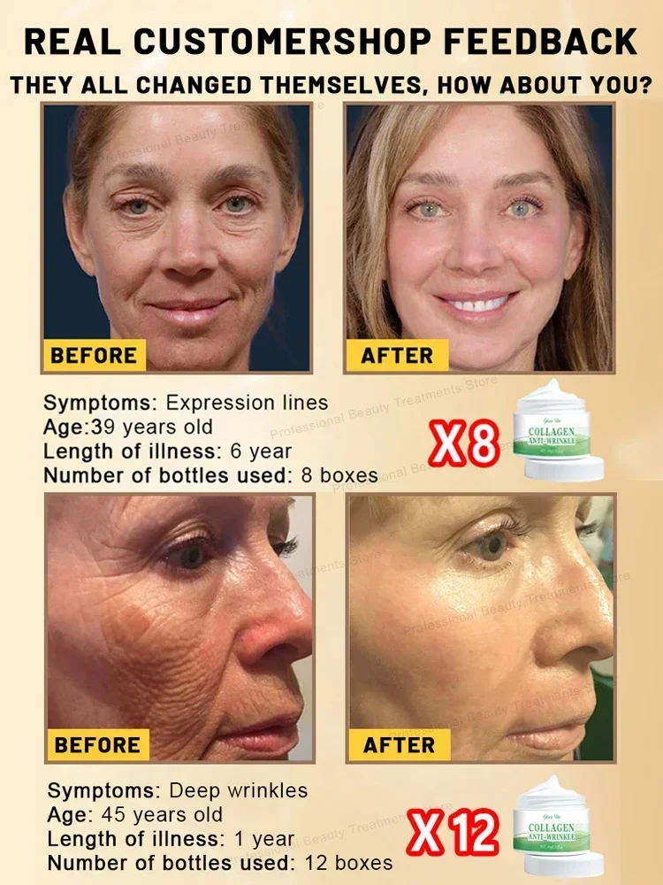 Wrinkles disappear