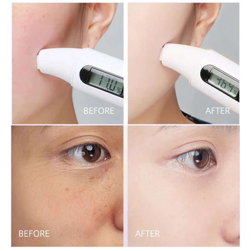 Рисунок 3 - Успокаивающая маска для лица против