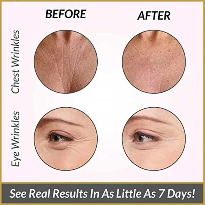 Reusable Silicone Wrinkle Removal Sticker Facial Lifting Strips Set Forehead Neck Line Remover Eye Patches Anti Aging Skin Pads 3