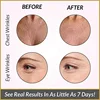 Reusable Silicone Wrinkle Removal Sticker Facial Lifting Strips Set Forehead Neck Line Remover Eye Patches Anti Aging Skin Pads 3