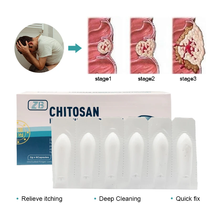 Hemorrhoid Ointment Treatment Internal And External Hemorrhoids And Anal Bleeding Relieve Swelling Pain herbal hemorrhoid treatment